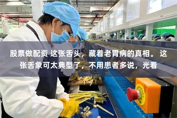 股票做配资 这张舌头，藏着老胃病的真相。 这张舌象可太典型了，不用患者多说，光看